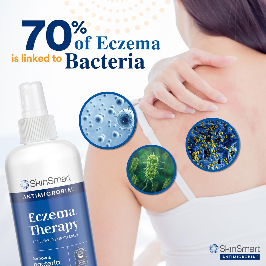skinsmart-antimicrobial-eczema-therapy-w-2.jpg