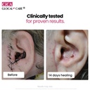 glocalcare-cica-clinically-proven-wound--6.jpg