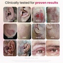 glocalcare-cica-clinically-proven-wound--4.jpg