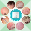 soothe-my-skin-cream-for-sensitive-skin--2.jpg