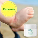soothe-my-skin-cream-for-sensitive-skin--5.jpg
