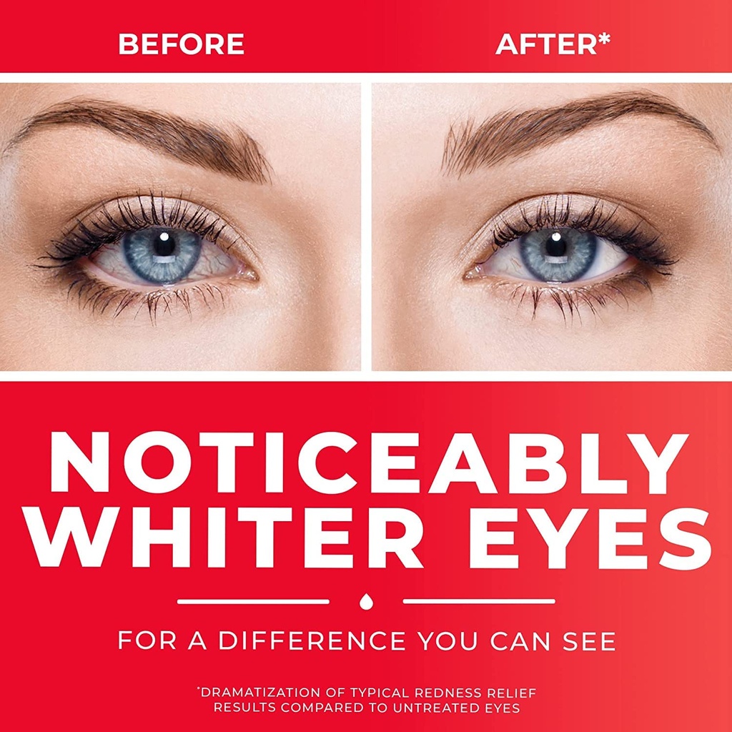 clear-eyes-redness-12hr-relief-eye-drops-4.jpg