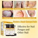 toenail-fungus-treatment-extra-strength--3.jpg
