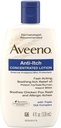 AVEENO Anti- Itch Lotion 4 oz (3 csomag)