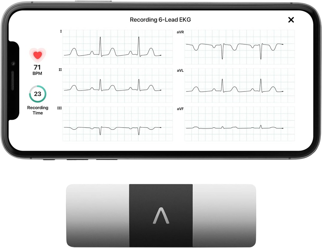 AliveCor KardiaMobile 6- Vezető személyes EKG monitor - Hat Nézetek A szív - Detects AFib és szabálytalan Arrhythmias - Azonnali eredmények 30 másodperc - Works with Most Smartphone