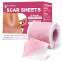 Szilikon hegek, szilikon hegek szalag Sebészeti hegek, C-Szekció, Tummy Tuck, Keloid Bump Removal, Face szalag ráncok Outnight (1.6 "X 59" Roll- 1.5M- Pigment redukcion- Pink)