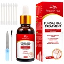 Láb Körömgombák Kezelés lábujjkörmök: Körömgomba Kezelés a körmök - Extra Erő, Fast- Action Solution for Cracked, Sérült, Elszíneződött körmök