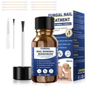 Lábbeli gombák kezelése, láb gomba kezelés extra erő, gomba köröm kezelés, láb gomba gombák kezelések gombák körmök sárga köröm kezelés (1fl oz / 30ml)