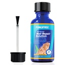 Körömgomba kezelés Extra Erő - Körömgomba Kezelés lábujjkörmök - Körömgomba kezelés Extra Erő - Körömgomba kezelés (30ml)