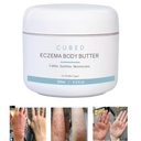 Cubed 4.5 oz Ekzema Cream felnőtteknek, Ekzema Relief, Ekzema Treatment, Moisturize Dry Irridated Skin, Smart Lotion for Topical Steroid Excroal Tünetek, Psoriasis & Rosacea, Ekzema, Dermatitis