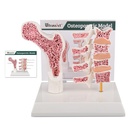 Ultrasszisztáló emberi anatómia osteoporosis modell, Vertebrae anatómiai csontváz modell tanulmányi kártya orvosi diák oktatási demonstráció