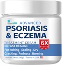 Bio- MD Psoriasis Eczema Cream, Ekzema Cream felnőtteknek, Extra Strength Control Reaction, Relieve Syndicant of Resistant, Hatékony Seborrheás Dermatitis, Folliculitis kezelés