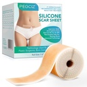 Szilikon hegek, szilikon hegek szalag, szilikon lapok hegek, Scar Away szilikon hegek az arc, Acne, Keloid, Burns, Stretch Mark, C-szakasz Sebészeti hegek eltávolítása (1.6 "x 60" Roll- 1.5M)