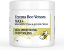 Magas erősségű Bee Venom Cream, Dyshidrotic ekzema kenőcs, hőkiütés, viszketés, ekzema, psoriasis, láb, gyomor, láb, kéz, irritált bőr, minden korosztály