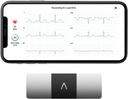 AliveCor KardiaMobile 6- Vezető személyes EKG monitor - Hat Nézetek A szív - Detects AFib és szabálytalan Arrhythmias - Azonnali eredmények 30 másodperc - Works with Most Smartphone