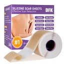 Szilikon hegek, szilikon hegek szalag (1.6 "x 79" Roll- 2M), újrahasználható Professzionális hegek szilikon csíkok, lágy szilikon hegek sebek, Keloid, Acne hegek, égési hegek, C-szakasz