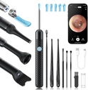 Loyker X6 Ear Wax Removal Tool Camera, Far Cleaner with Camera, FSA - HSA Store Areable, 1080P Ear Camera 6LED Light for ear / orr / torok / Tonsil Stone Examination, Black